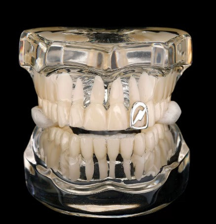 Grillz Éclair - Minimaliste