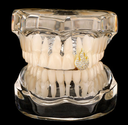 Grillz Flamme Or & Strass – L’Éclat Suprême