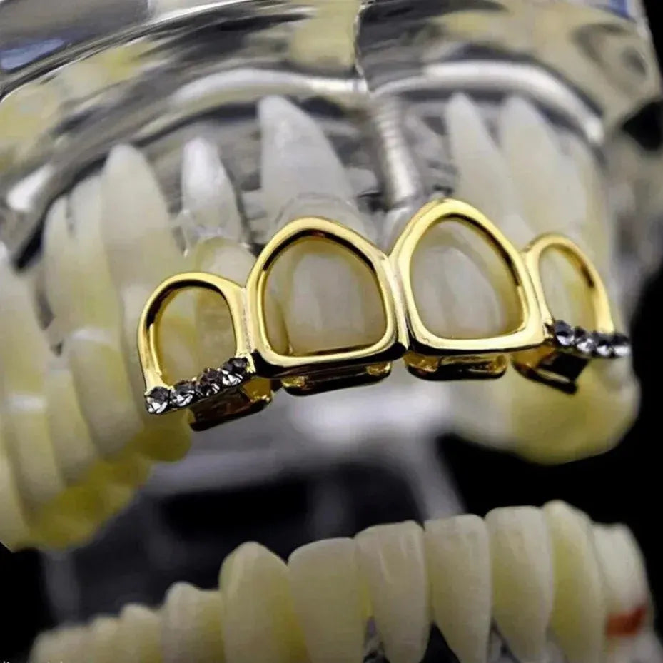 Grillz Dent Creuse Givrée – Set