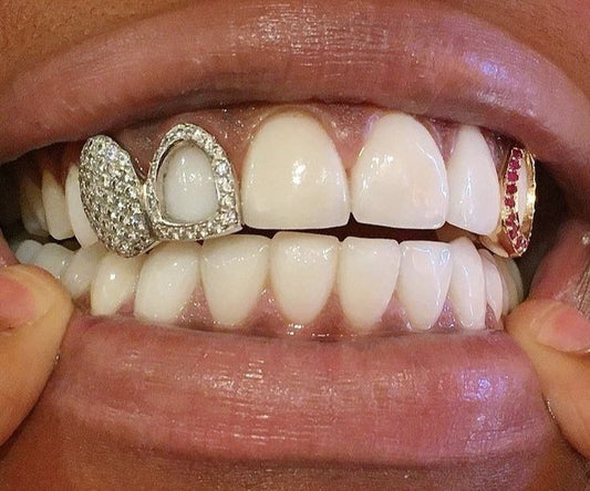 Grillz Double Dent et Flèche Givrés