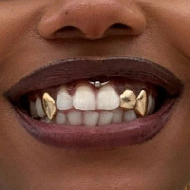 Grillz Canines Plaquées – Double Dent