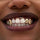 Grillz Canines Plaquées – Double Dent